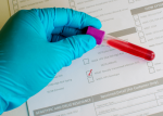 What Are the Signs You Need an STD Test?