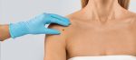 Skin Tag Removal in Dubai